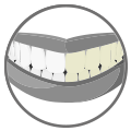 BLANQUEAMIENTO DENTAL